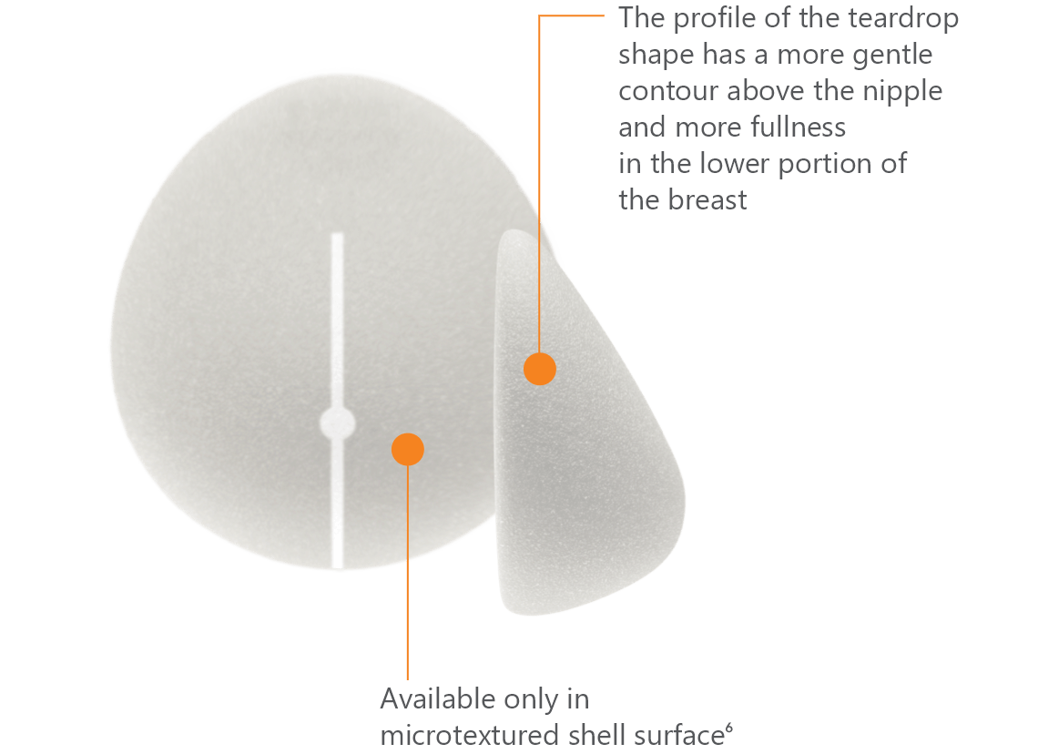 Teardrop shape implant. The profile of the teardrop shape has a more gentle contour above the nipple and more fullness in the lower portion of the breast. Available only in microtextured shell surface