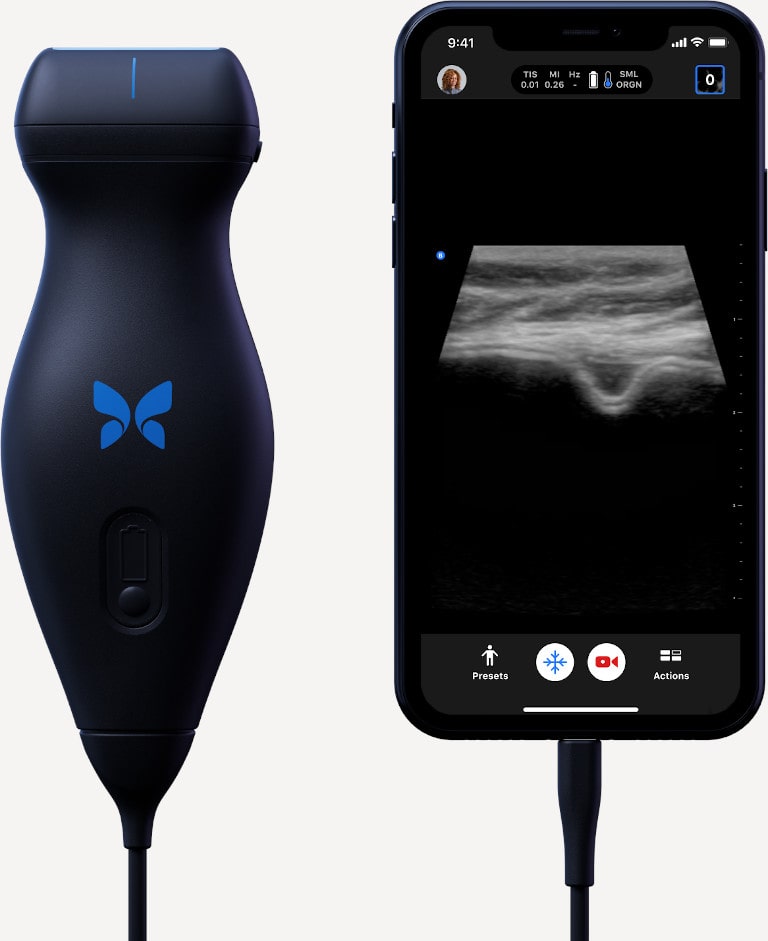Butterfly device beside smart phone showing imaging