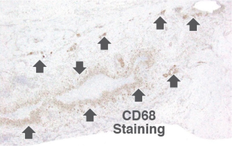 AlloDerm CD68 Staining image