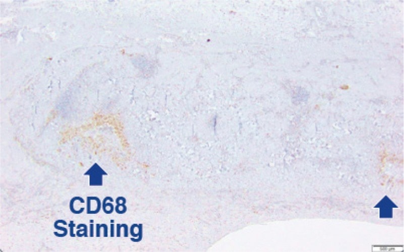 SimpliDerm CD68 Staining image