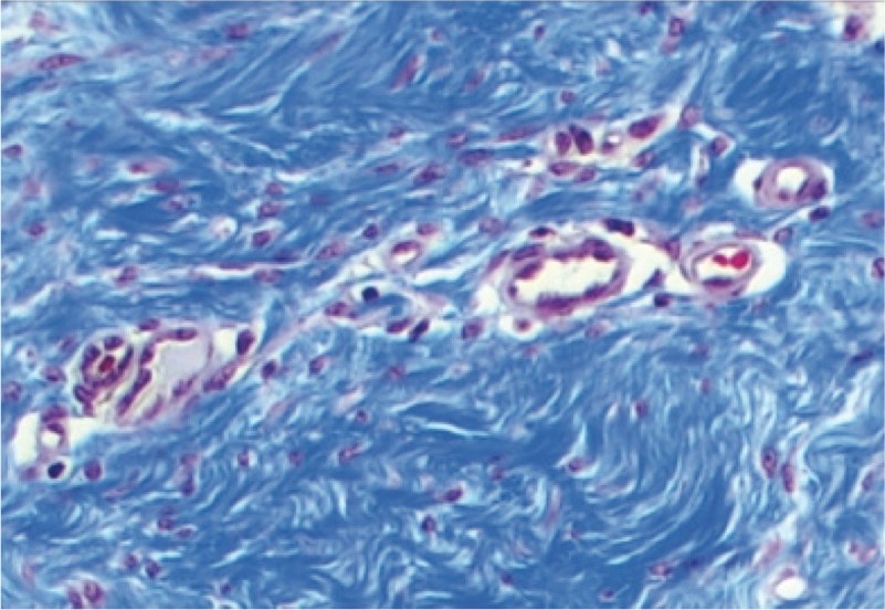 Robust tissue generation at 12 weeks